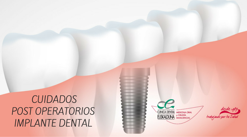CUIDADOSPOST OPERATORIOS IMPLANTE DENTAL