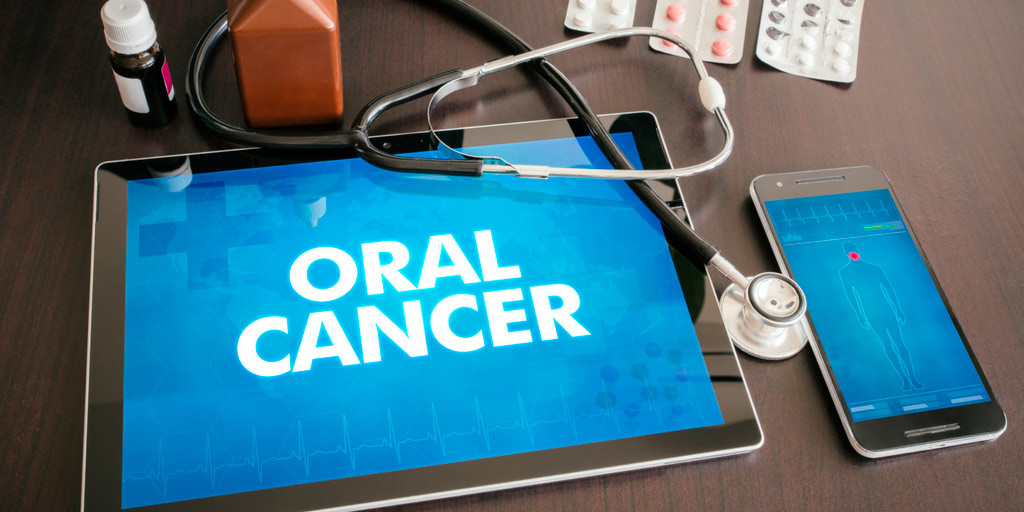 cancer-oral-diagnostico cancer-oral-diagnostico