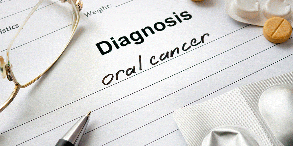 cancer-oral cancer-oral