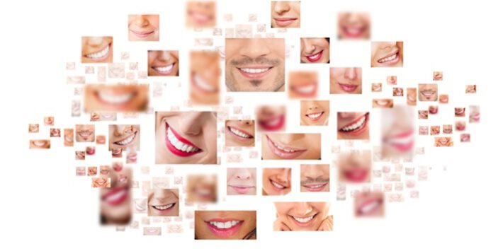 dientes blancos dientes blancos