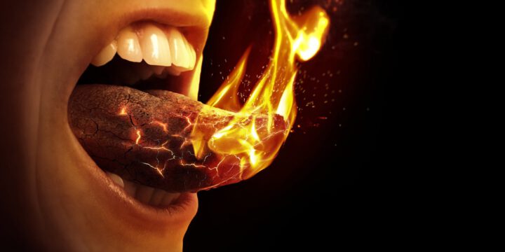 Síndrome de Boca Ardiente