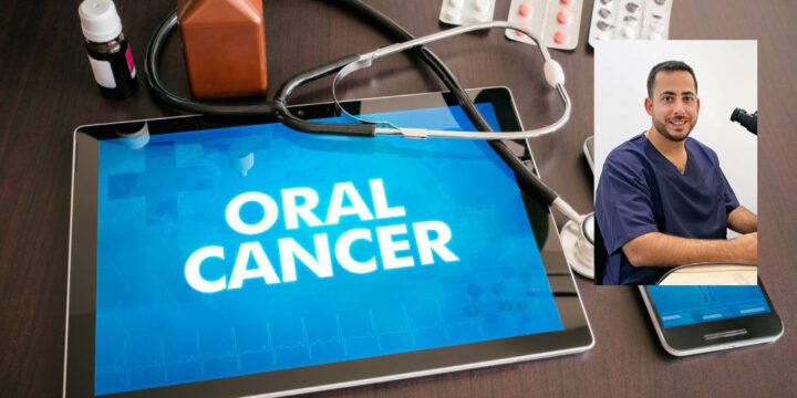 tratamiento-cancer-oral tratamiento cáncer oral