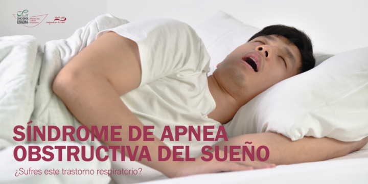 SAOS Síndrome de Apnea Obstructiva del Sueño (SAOS)