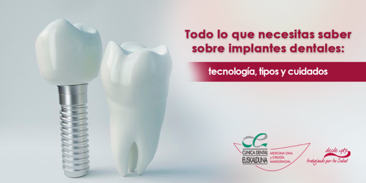 Todo lo que necesitas saber sobre implantes dentales Todo lo que necesitas saber sobre implantes dentales